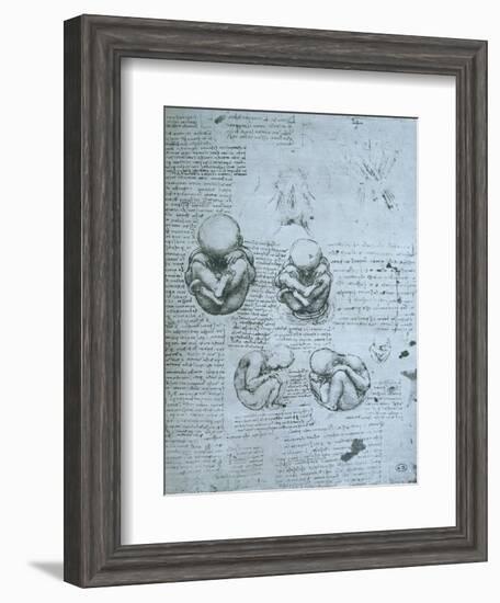 Five Views of a Foetus in the Womb, Facsimile Copy-Leonardo da Vinci-Framed Giclee Print