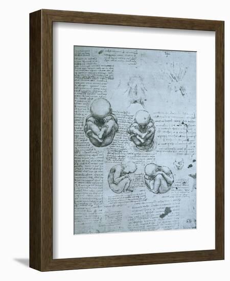 Five Views of a Foetus in the Womb, Facsimile Copy-Leonardo da Vinci-Framed Giclee Print