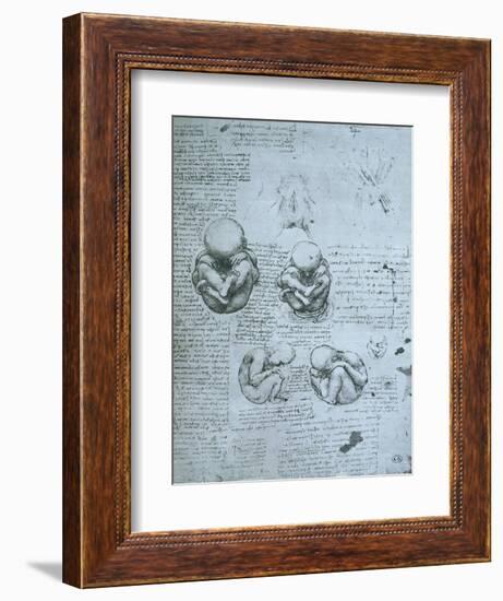 Five Views of a Foetus in the Womb, Facsimile Copy-Leonardo da Vinci-Framed Giclee Print