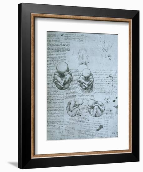 Five Views of a Foetus in the Womb, Facsimile Copy-Leonardo da Vinci-Framed Giclee Print