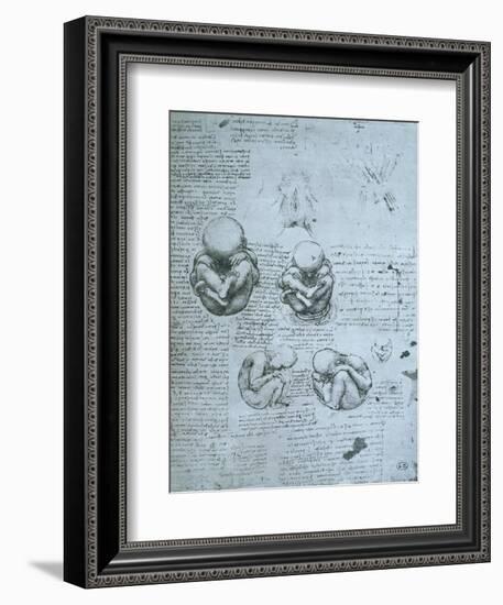 Five Views of a Foetus in the Womb, Facsimile Copy-Leonardo da Vinci-Framed Giclee Print