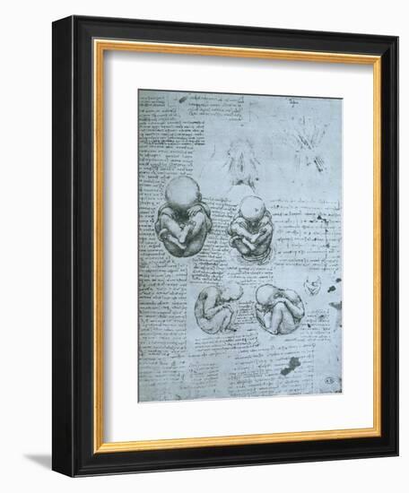 Five Views of a Foetus in the Womb, Facsimile Copy-Leonardo da Vinci-Framed Giclee Print