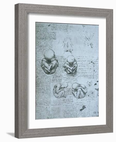 Five Views of a Foetus in the Womb, Facsimile Copy-Leonardo da Vinci-Framed Giclee Print