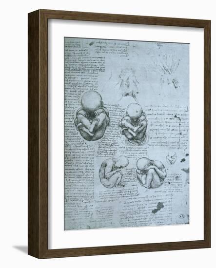 Five Views of a Foetus in the Womb, Facsimile Copy-Leonardo da Vinci-Framed Giclee Print