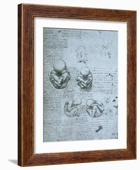 Five Views of a Foetus in the Womb, Facsimile Copy-Leonardo da Vinci-Framed Giclee Print