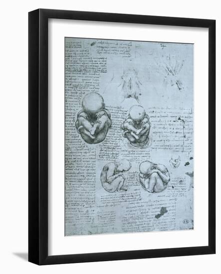 Five Views of a Foetus in the Womb, Facsimile Copy-Leonardo da Vinci-Framed Giclee Print