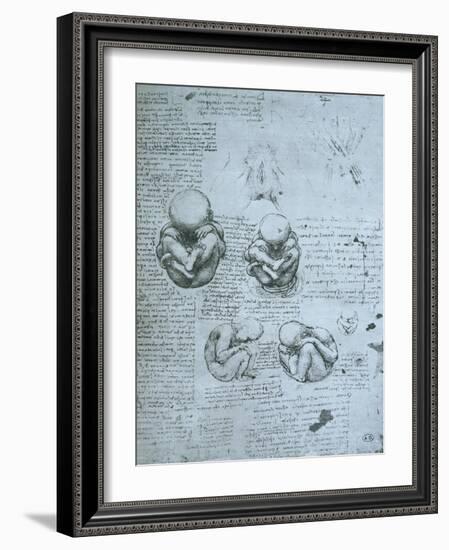 Five Views of a Foetus in the Womb, Facsimile Copy-Leonardo da Vinci-Framed Giclee Print