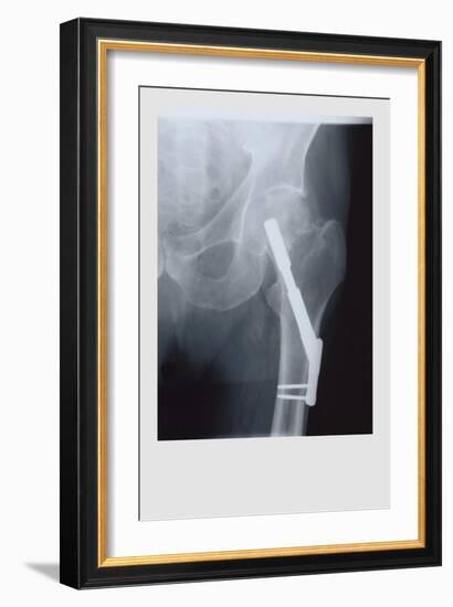 Fixed Femur-null-Framed Premium Giclee Print