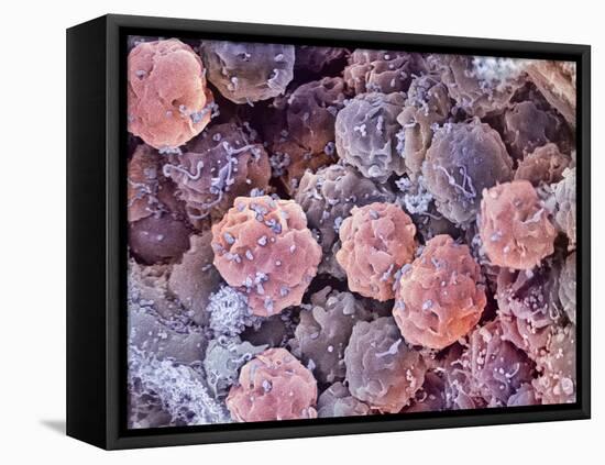 Foetal Blood Stem Cells, SEM-Steve Gschmeissner-Framed Premier Image Canvas