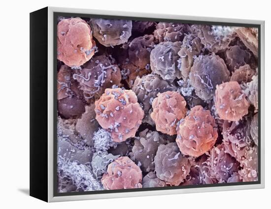 Foetal Blood Stem Cells, SEM-Steve Gschmeissner-Framed Premier Image Canvas