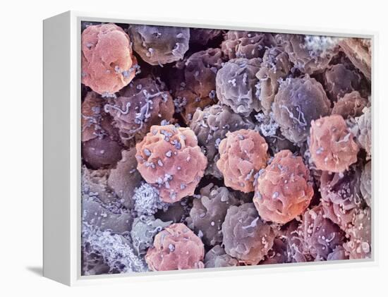 Foetal Blood Stem Cells, SEM-Steve Gschmeissner-Framed Premier Image Canvas