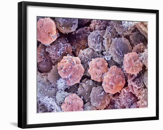 Foetal Blood Stem Cells, SEM-Steve Gschmeissner-Framed Photographic Print