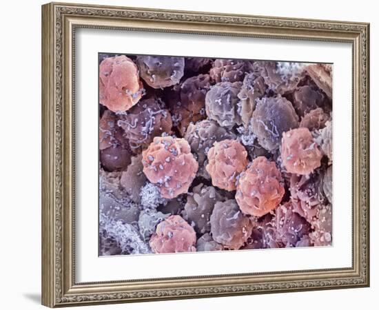 Foetal Blood Stem Cells, SEM-Steve Gschmeissner-Framed Photographic Print