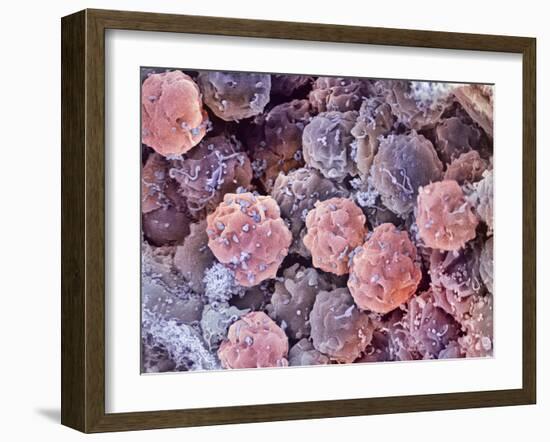 Foetal Blood Stem Cells, SEM-Steve Gschmeissner-Framed Photographic Print