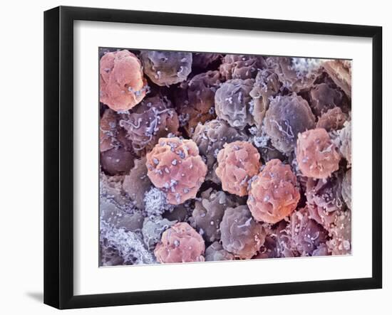 Foetal Blood Stem Cells, SEM-Steve Gschmeissner-Framed Photographic Print