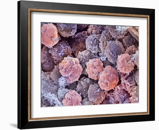 Foetal Blood Stem Cells, SEM-Steve Gschmeissner-Framed Photographic Print