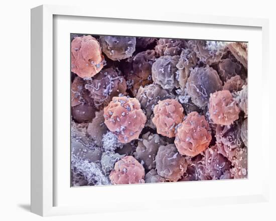 Foetal Blood Stem Cells, SEM-Steve Gschmeissner-Framed Photographic Print