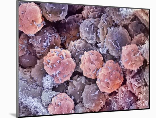 Foetal Blood Stem Cells, SEM-Steve Gschmeissner-Mounted Photographic Print