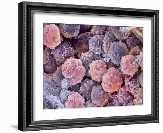 Foetal Blood Stem Cells, SEM-Steve Gschmeissner-Framed Photographic Print