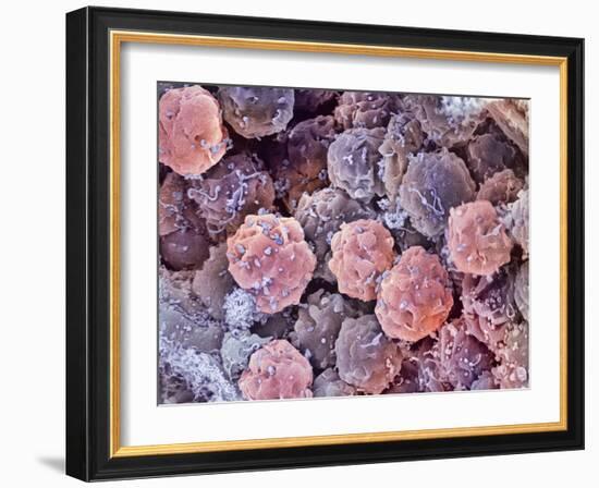 Foetal Blood Stem Cells, SEM-Steve Gschmeissner-Framed Photographic Print