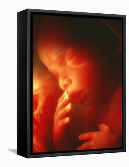 Foetus Aged 5 Months-Neil Bromhall-Framed Premier Image Canvas