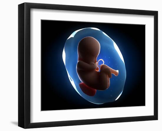 Foetus, Artwork-SCIEPRO-Framed Photographic Print