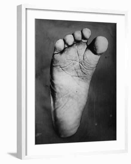 Foot of Young Boy-null-Framed Photographic Print