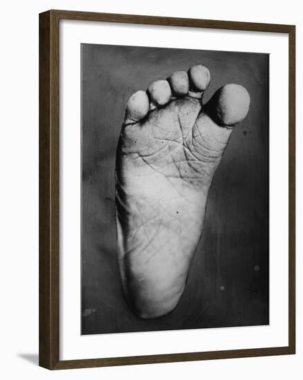 Foot of Young Boy-null-Framed Photographic Print