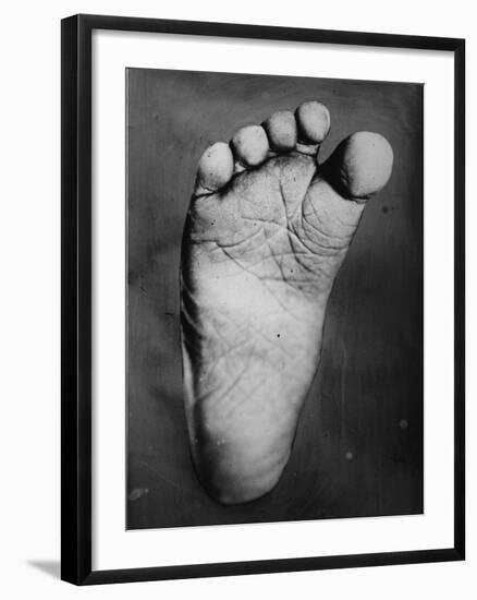 Foot of Young Boy-null-Framed Photographic Print