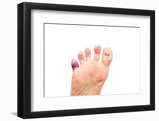 Foot Problems, Broken Toe and Calluses-soupstock-Framed Photographic Print