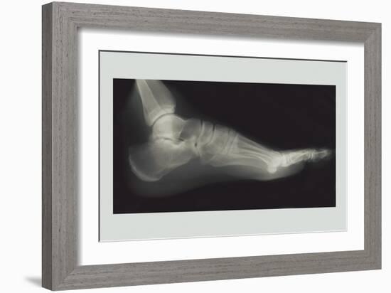 Foot-null-Framed Art Print