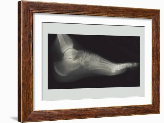 Foot-null-Framed Art Print