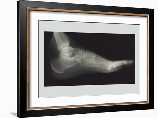 Foot-null-Framed Art Print