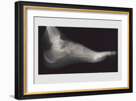 Foot-null-Framed Premium Giclee Print