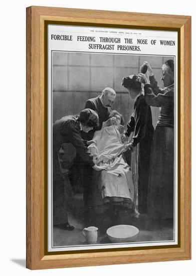 Forcible Feeding Through the Nose of Women Suffragist Prisoners-null-Framed Premier Image Canvas