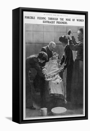 Forcible Feeding Through the Nose of Women Suffragist Prisoners-null-Framed Premier Image Canvas