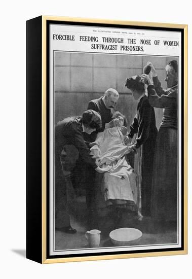 Forcible Feeding Through the Nose of Women Suffragist Prisoners-null-Framed Premier Image Canvas