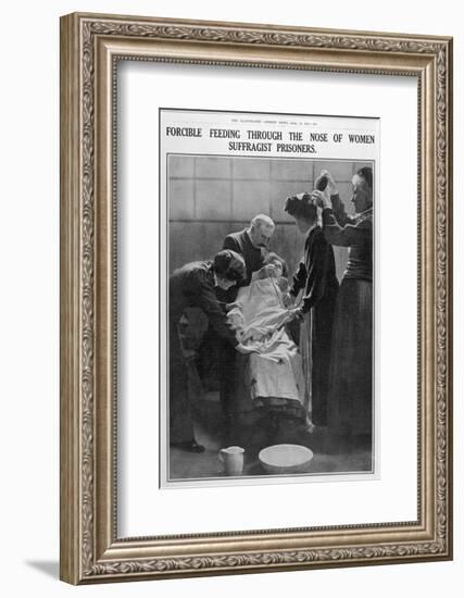 Forcible Feeding Through the Nose of Women Suffragist Prisoners-null-Framed Photographic Print