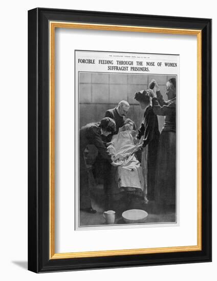 Forcible Feeding Through the Nose of Women Suffragist Prisoners-null-Framed Photographic Print