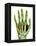 Fractured Palm Bones of Hand, X-ray-Science Photo Library-Framed Premier Image Canvas