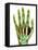 Fractured Palm Bones of Hand, X-ray-Science Photo Library-Framed Premier Image Canvas