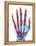 Fractured Palm Bones of Hand, X-ray-Science Photo Library-Framed Premier Image Canvas