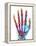 Fractured Palm Bones of Hand, X-ray-Science Photo Library-Framed Premier Image Canvas