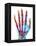 Fractured Palm Bones of Hand, X-ray-Science Photo Library-Framed Premier Image Canvas