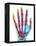 Fractured Palm Bones of Hand, X-ray-Science Photo Library-Framed Premier Image Canvas