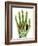 Fractured Palm Bones of Hand, X-ray-Science Photo Library-Framed Photographic Print