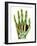 Fractured Palm Bones of Hand, X-ray-Science Photo Library-Framed Photographic Print