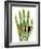 Fractured Palm Bones of Hand, X-ray-Science Photo Library-Framed Photographic Print