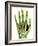 Fractured Palm Bones of Hand, X-ray-Science Photo Library-Framed Photographic Print