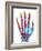 Fractured Palm Bones of Hand, X-ray-Science Photo Library-Framed Photographic Print